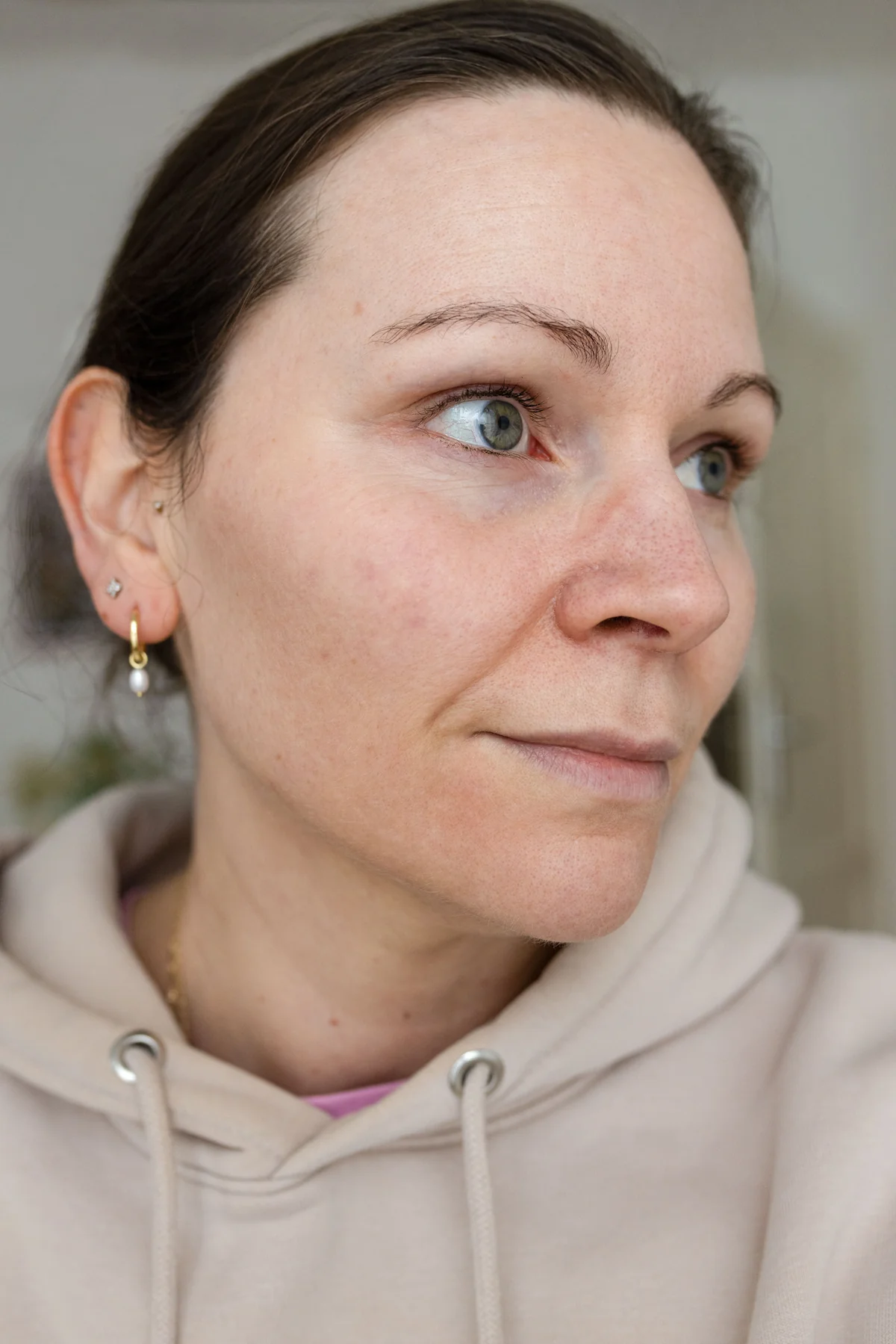 Vorher-Bild vor Anwendung des ZIIP Halo 2.0 mit sichtbarer Hautstruktur und leichten Rötungen im Wangenbereich