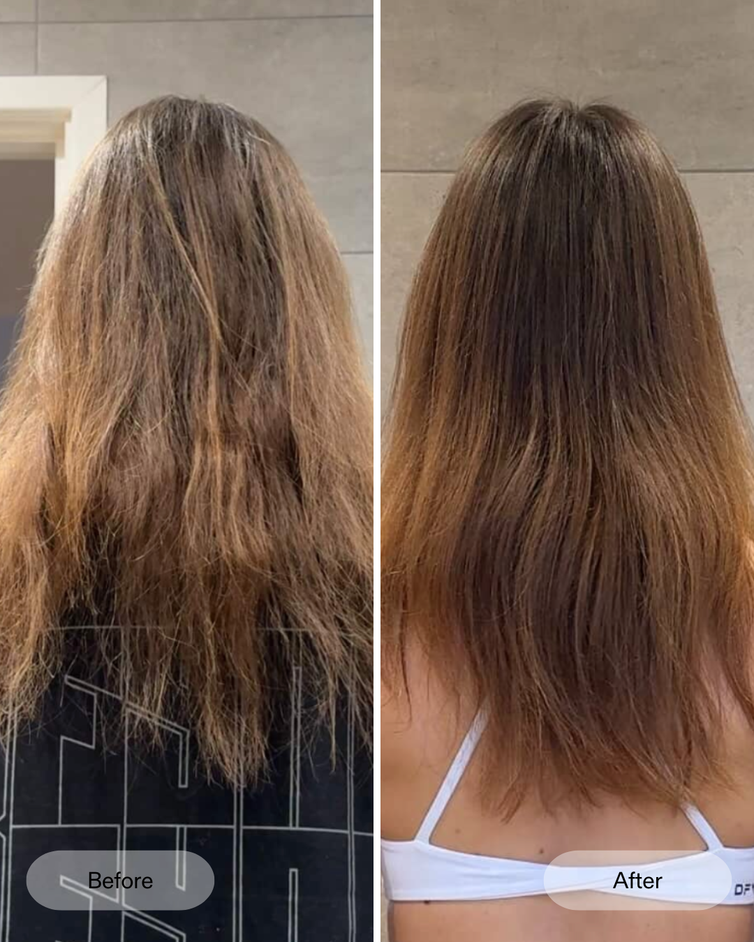 Vorher Nachher Ergebnisse der klinischen Studie zum CurrentBody Skin LED-Haarwuchshelm gegen Haarausfall